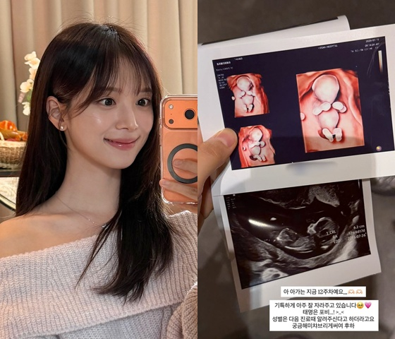 /사진=김지영 SNS