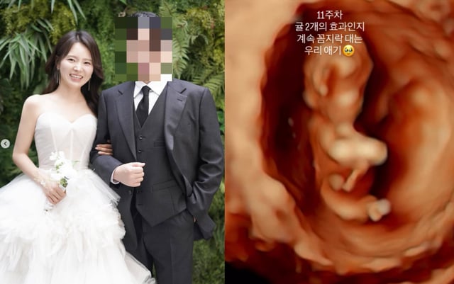 /사진=19기 영숙 SNS