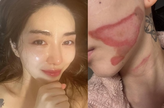 /사진=권민아 SNS