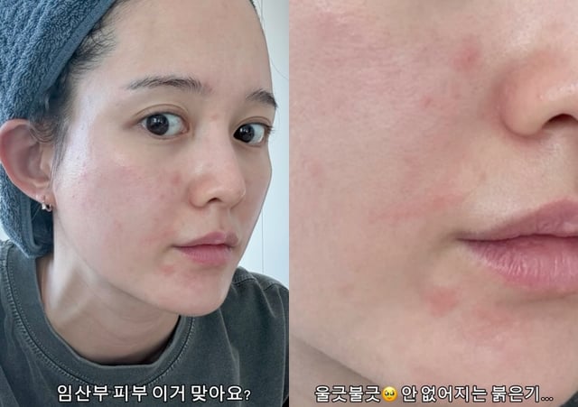 /사진=남보라 SNS