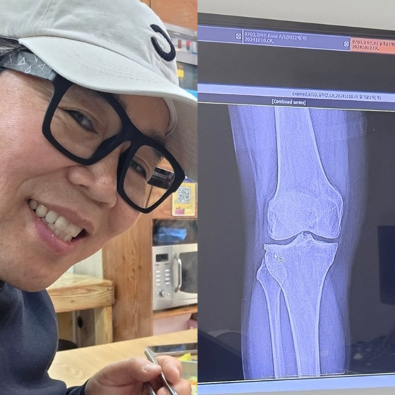 /사진=정은표 SNS