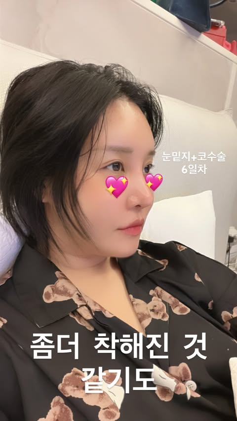 /사진=랄랄 SNS