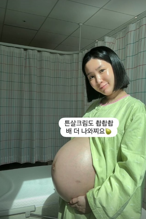 초아 / 사진=개인계정