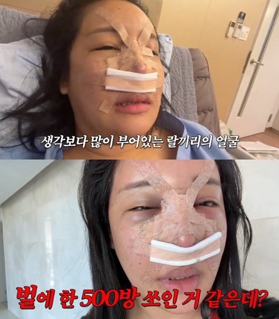 /사진=랄랄 유튜브