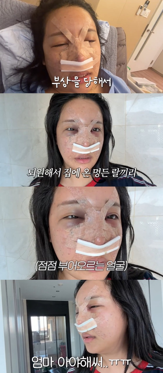 /사진=랄랄 유튜브