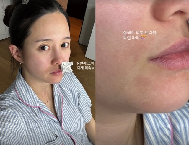 /사진=남보라 SNS