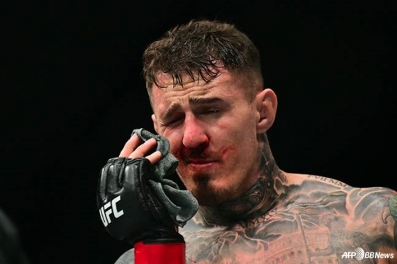 Tom Aspinall is in pain as he frowns during the match against Cyril Gane. /AFPBBNews=News1