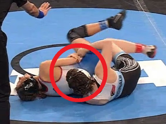전미대학체육협회(NCAA) 여자 레슬링 경기에서 선수가 자신의 팔을 물었다는 자작극 논란이 불거졌다. /사진=데일리메일 갈무리