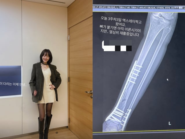 /사진=엄지원 SNS