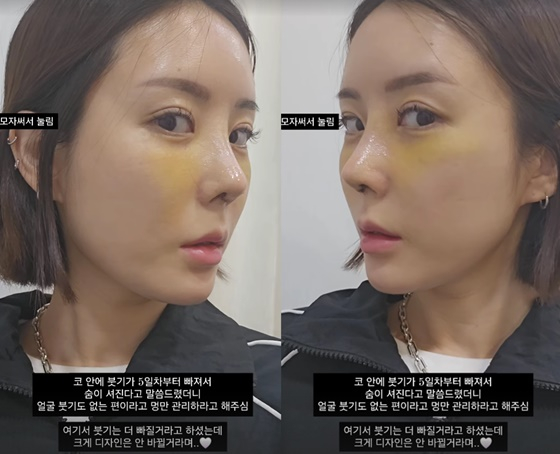 /사진=이소라 SNS