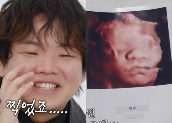 /사진=SBS '아니 근데 진짜!' 캡처