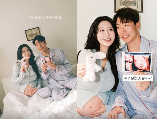 /사진=나비 SNS