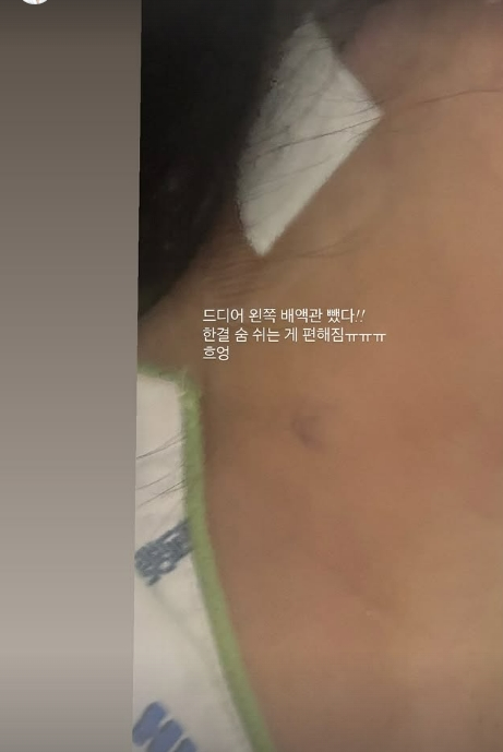 /사진=6기 영숙 SNS