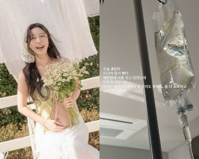 /사진=나비 SNS