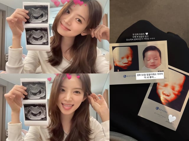 사진=김지영 인스타그램