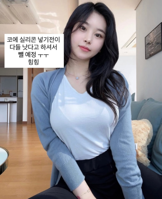 노슬비 /사진=노슬비 인스타그램