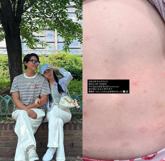 /사진=아야네 SNS