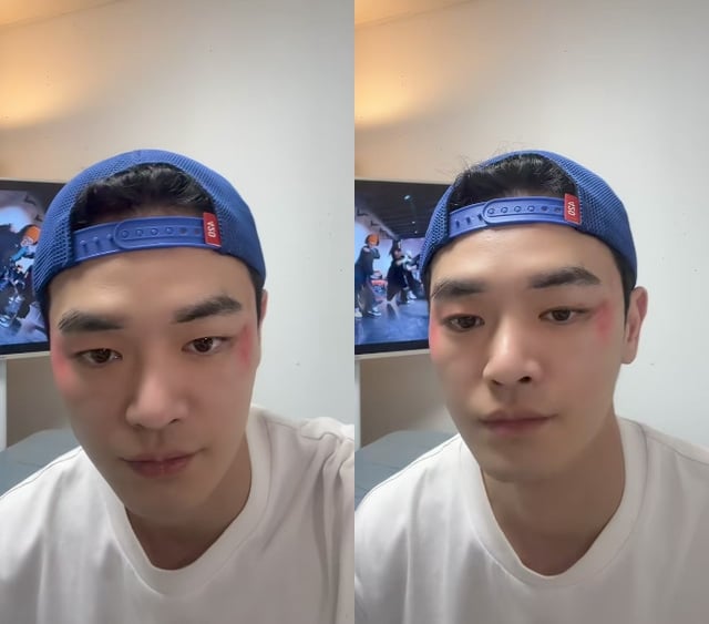 장동주 / 사진=장동주 SNS