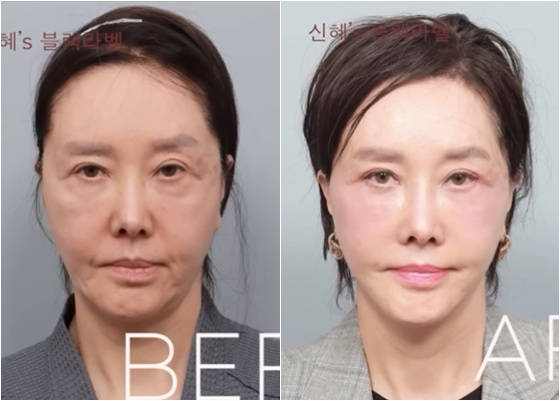 유혜리/사진=유튜브 블랙라벨