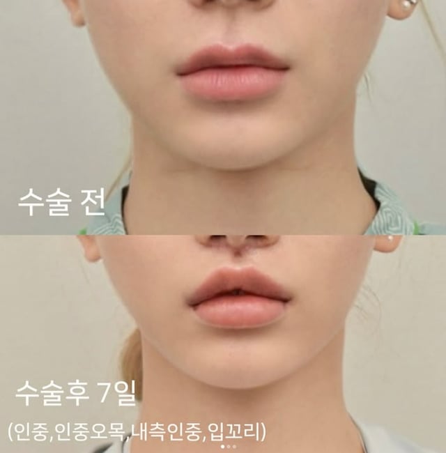/Foto=Redes sociales de Meng Seung-ji