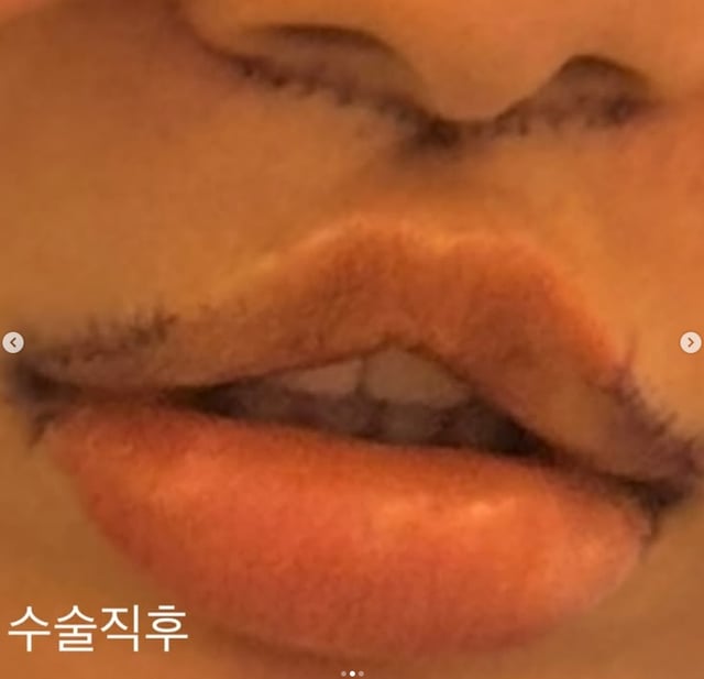 /Foto=Redes sociales de Meng Seung-ji