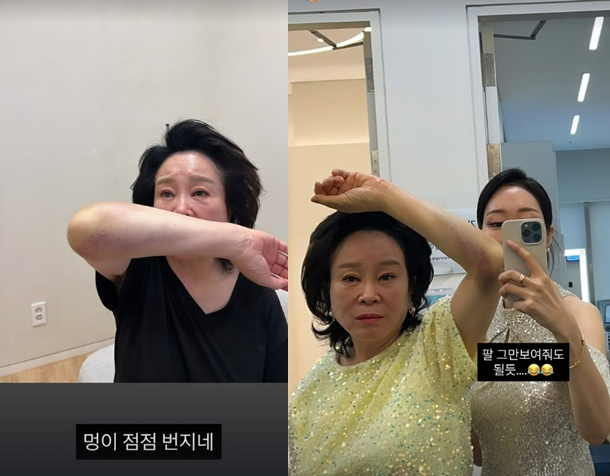 /사진=미자 SNS