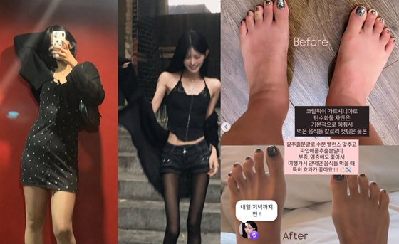 Choi Jun-hee Before and After Diet /Photo=Choi Jun-hee SNS