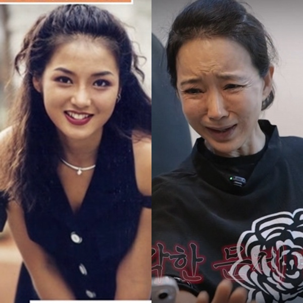 /사진=채널A '뷰티 클리닉 터치미'