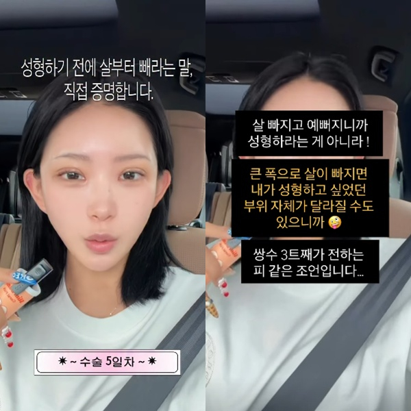 /사진=최준희 SNS