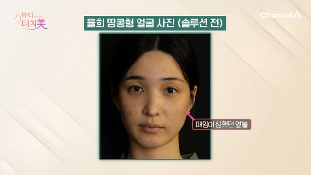 /Photo=Broadcast screen capture