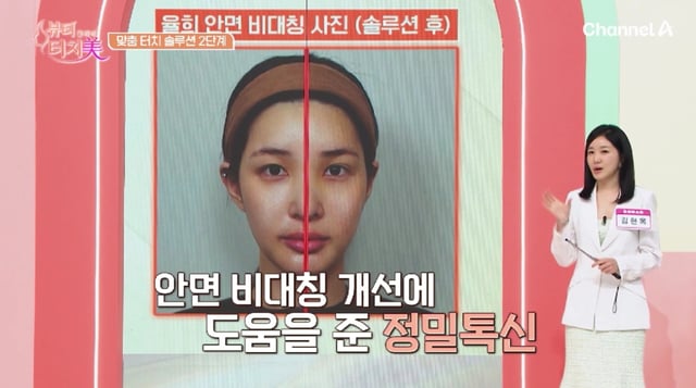 /Photo=Broadcast screen capture