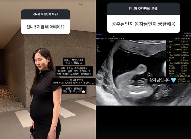 /Photo=Hong Yoo-kyung SNS
