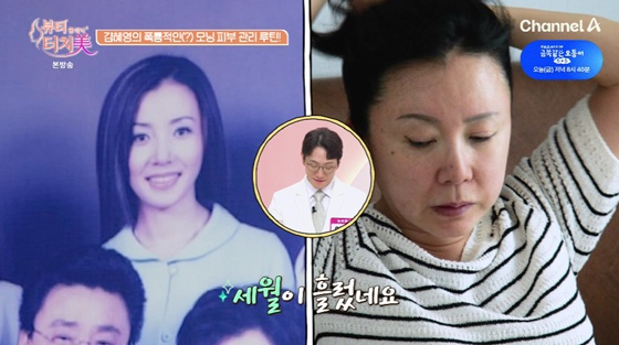 김혜영/사진=채널A 뷰티 클리닉 터치미