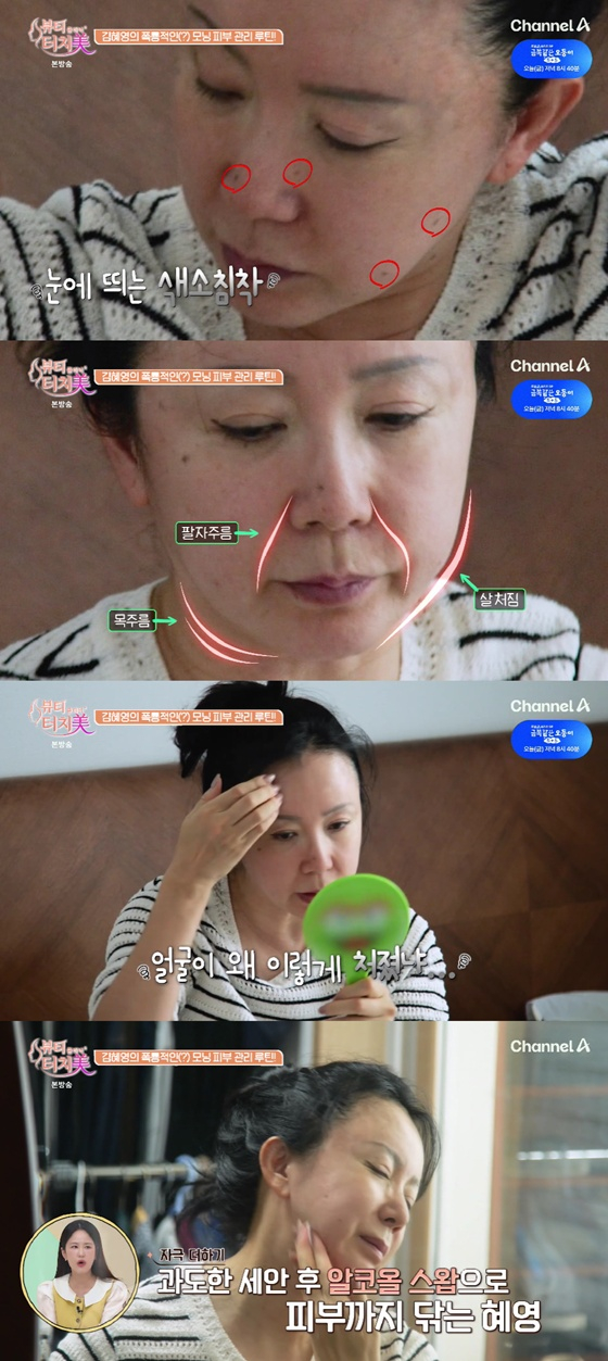 김혜영/사진=채널A 뷰티 클리닉 터치미