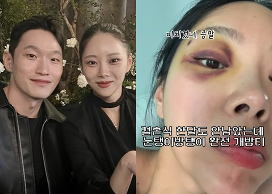 /Photo=Kim Seul-ki's SNS