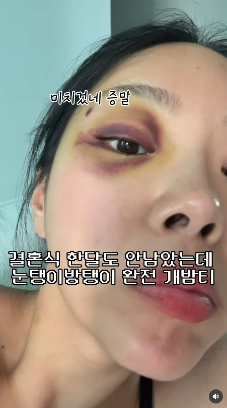 /Photo=Kim Seul-ki's SNS