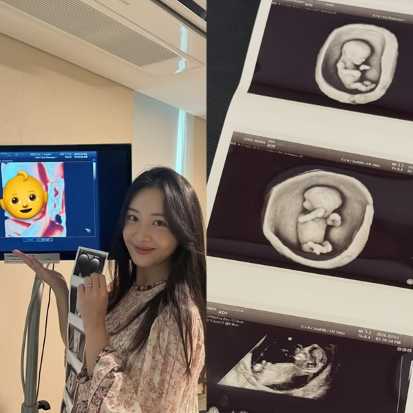 /사진=김다영 SNS