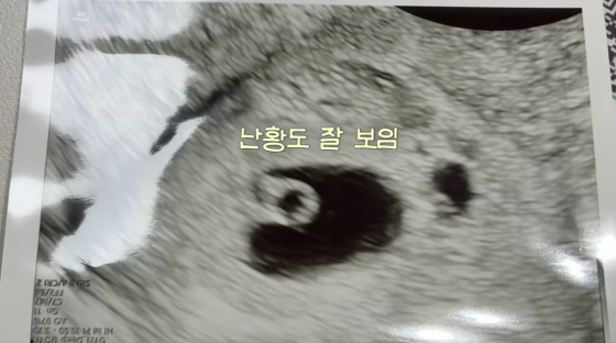 /사진=류이서 유튜브 계정