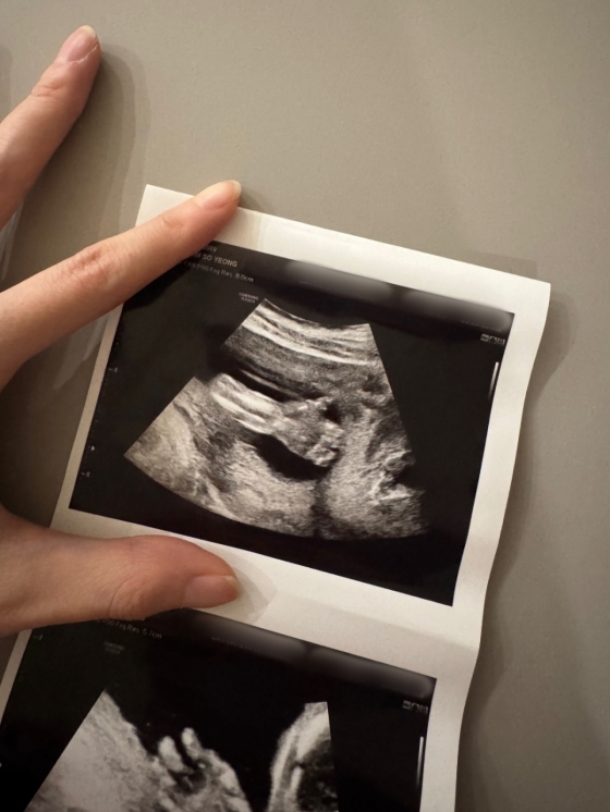 /写真=キム·ソヨンSNS