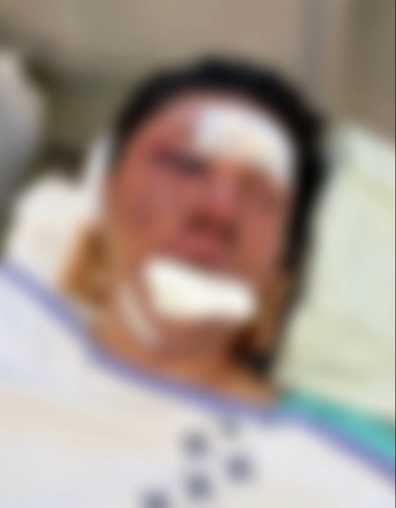 /写真=SOOP雄鶏チャンネルキャプチャー