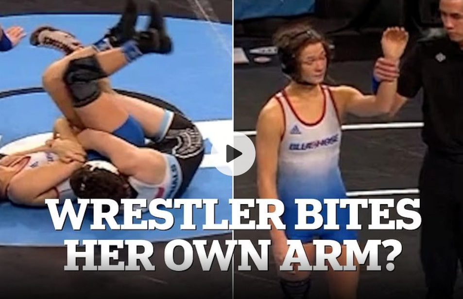 Britain's Daily Mail reported on the 7th (local time) that the first NCAA women's wrestling tournament in history was embroiled in controversy over allegations that he bit his arm to disqualify the opponent. /Photo = Daily Mail Source
