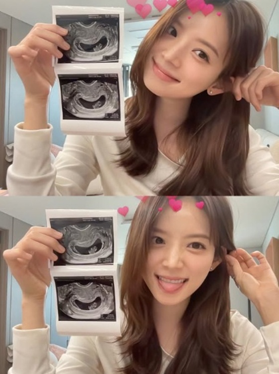 /Фото = Ким Джи Ён sns