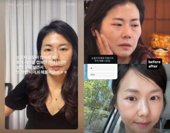 /Ảnh = SNS của Young Sook kỳ 28