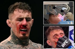 충격 "4분 동안 눈 3번 찔렸다" UFC 챔피언, 피눈물에 분노할 만... "수술 2번 받았는데 복귀 좌절"