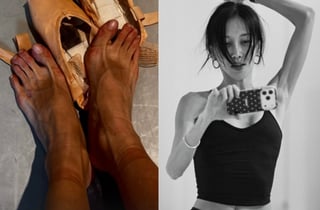 윤혜진, 영광의 상처 가득한 발 공개..휜 발가락+까진 피부