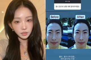 '성괴 인정' 최준희 "할거 너무 많다" 추가 성형 고민中[스타이슈]